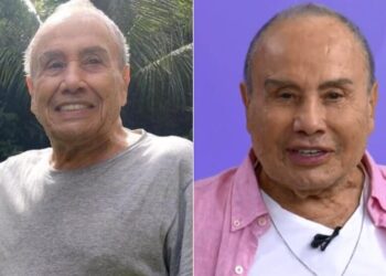 Stênio Garcia passa por procedimento de harmonização facial e surpreende fãs de “Carga Pesada”
