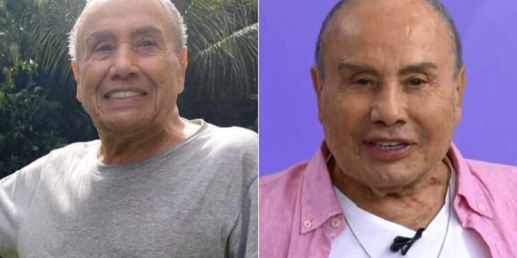 Stênio Garcia passa por procedimento de harmonização facial e surpreende fãs de “Carga Pesada”