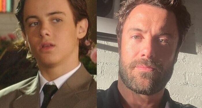 Ator Kayky Brito em estado gravíssimo após ser atropelado por motorista de aplicativo na Barra da Tijuca